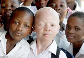 black albino